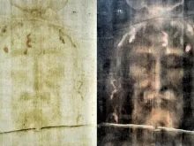 صورة للجزء العلويّ من كفن تورينو